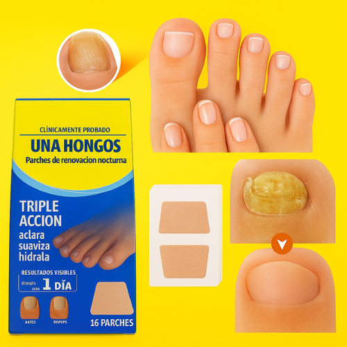 Tratamiento de Uñas – Elimina Hongos – Recupera su Aspecto Natural